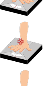Weight Bearing Test 3x onder elkaar